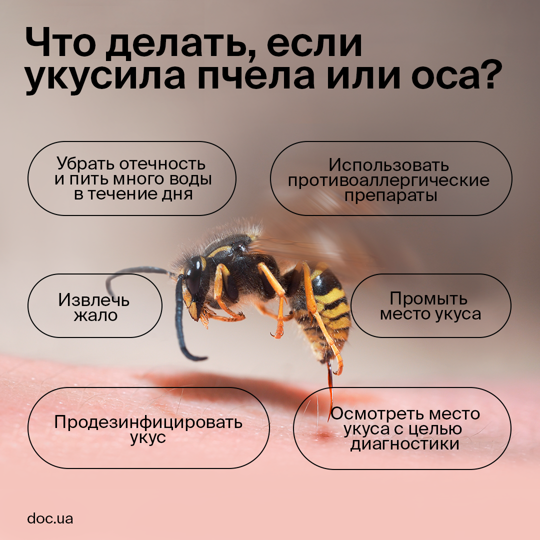 Укусы пчелы - довольно распространенная проблема, с которой сталкиваются многие люди. Пострадавший может испытывать острую боль и неудобства в месте укуса. Также возможна аллергическая реакция на укус пчелы, что может быть опасным для здоровья.