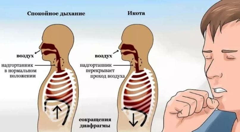 Первое, что нужно сделать - обратиться к наиболее простым и доступным методам. Попробуйте задержать дыхание на несколько секунд, затем медленно выдохнуть. Это поможет расслабить диафрагму и устранить икоту. Также можно попробовать выпить стакан воды, поскольку глотание стимулирует работу гортани и снимает спазмы.