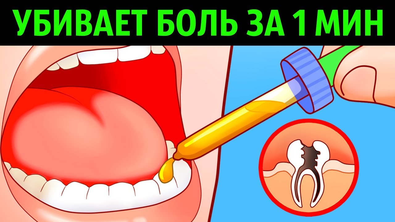Обезболивающие средства при зубной боли
