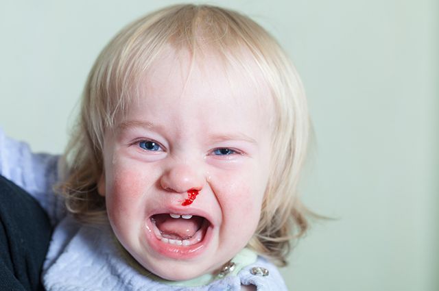 Наиболее простые и распространенные причины, которые могут вызвать кровь из носа у ребенка