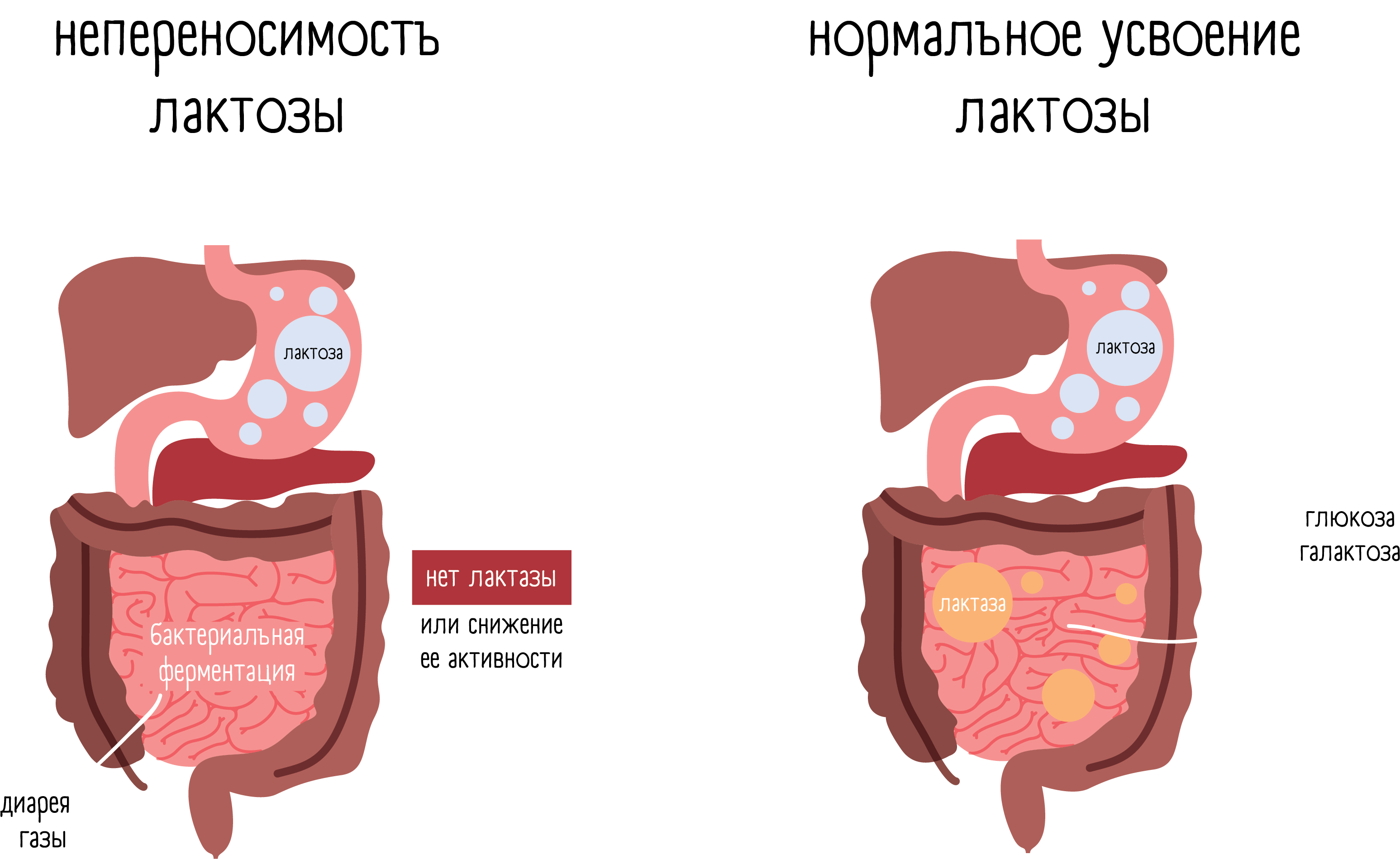Аллергия на молоко лактоза. Лактулоза непереносимость. Неперенсоимостьлктозы. Переносимость лактозы. Непереносимость лактозы симптомы.