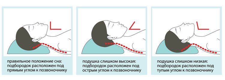 Подушка – это один из важнейших предметов для комфортного сна. От выбора подушки зависит не только качество отдыха, но и здоровье позвоночника. Правильно подобранная подушка обеспечивает оптимальную поддержку головы и шеи во время сна, помогает снять нагрузку с мышц и суставов, а также улучшает кровообращение.