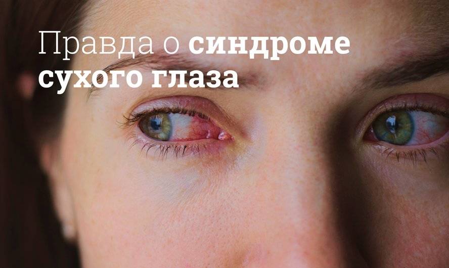 Синдром сухого глаза: причины