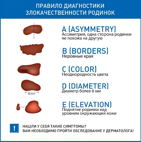 Как предотвратить появление родинок