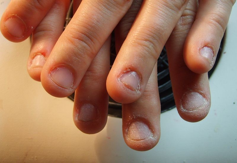 Грызть ногти - это пагубная привычка, которую многие люди имеют. Очень многие женщины даже не подозревают о том, что такими небольшими действиями, как грызть ногти, можно нанести вред своему здоровью.