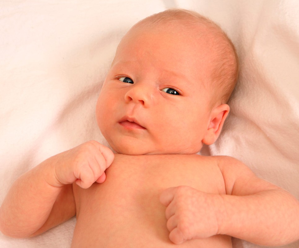 Симптомы кривошеи у новорожденных