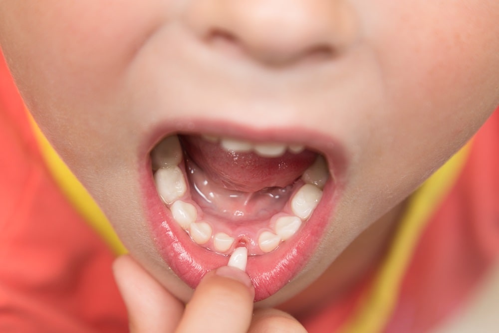 Когда у детей начинают выпадать молочные зубы