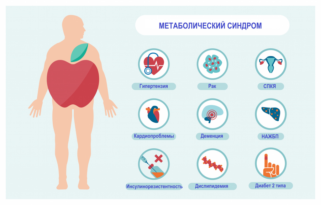 Метаболический синдром