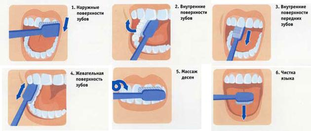 Кариес - это распространенное заболевание зубов, которое вызывается действием кариозных бактерий. Одним из важных факторов, способствующих кариозным поражениям, является налет - тонкий слой бактерий и продуктов их деятельности, который образуется на зубах.