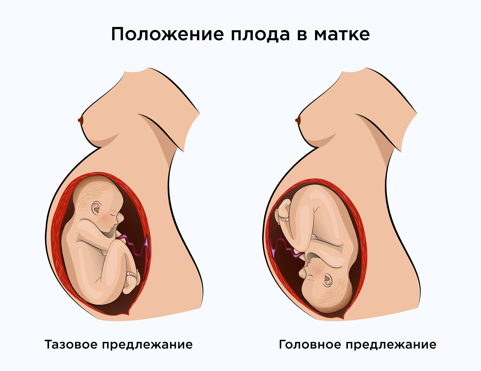 Роды в 36 недель опасно или нет