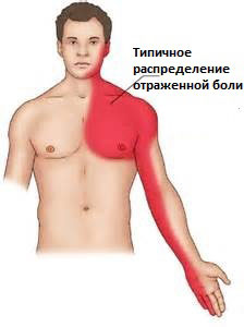 Причины болей в грудной клетке
