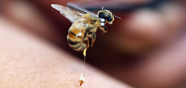 При аллергических реакциях на укусы пчелы, таких как сильная боль, зуд, отек и покраснение вокруг места укуса, пострадавший может испытывать серьезные проблемы со здоровьем. В таких случаях необходимо вызвать скорую помощь и сообщить о произошедшем укусе пчелы.